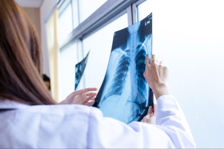 The Impact of Advanced X-Ray Scanner Technology on Safety Protocols
